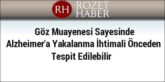 Göz Muayenesi Sayesinde Alzheimer'a Yakalanma İhtimali Önceden Tespit Edilebilir Göz Muayenesi Sayesinde Alzheimer'a Yakalanma İhtimali Önceden Tespit Edilebilir