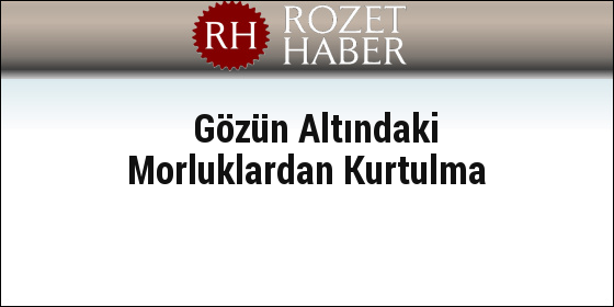 Gözün Altındaki Morluklardan Kurtulma Gözün Altındaki Morluklardan Kurtulma
